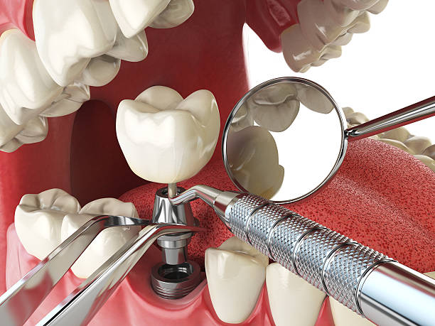 Best Broken or Cracked Tooth Emergency Dentist in Shannon, GA